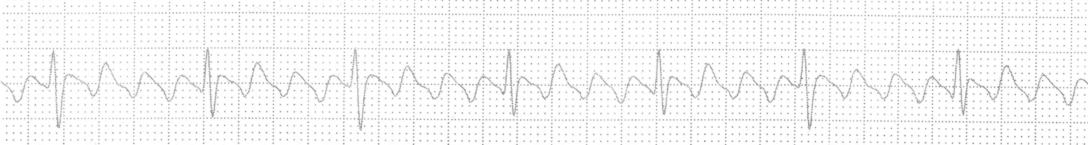 Imagen clínica de la pregunta de Cardiovascular y Respiratorio