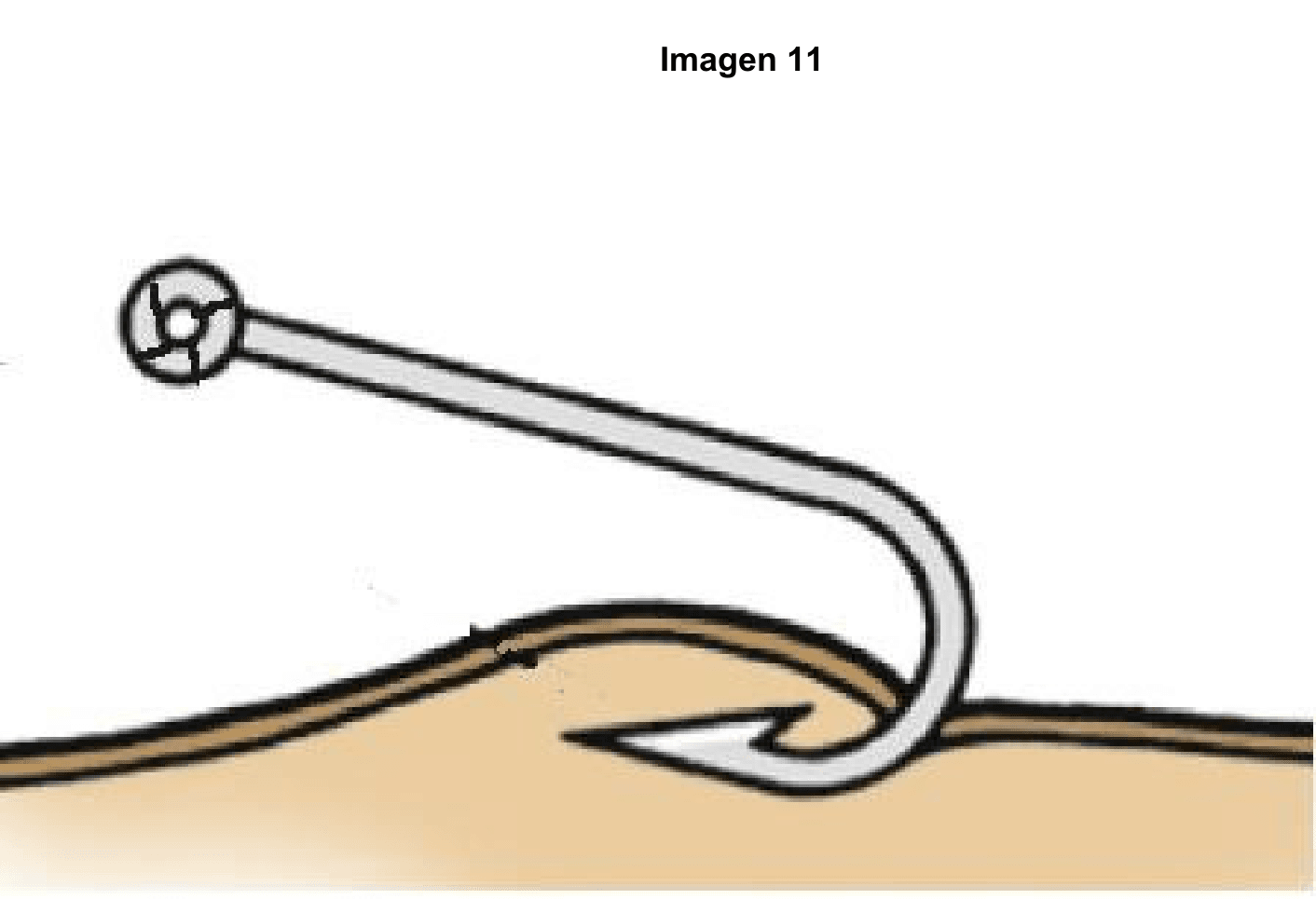 Imagen clínica de la pregunta de Traumatología y Cuidado de Heridas
