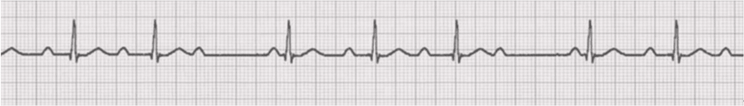 Imagen clínica de la pregunta de Cardiovascular y Respiratorio