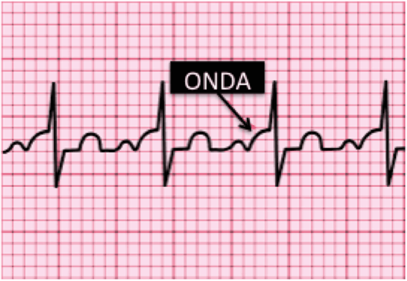 Imagen clínica de la pregunta de Cardiovascular y Respiratorio