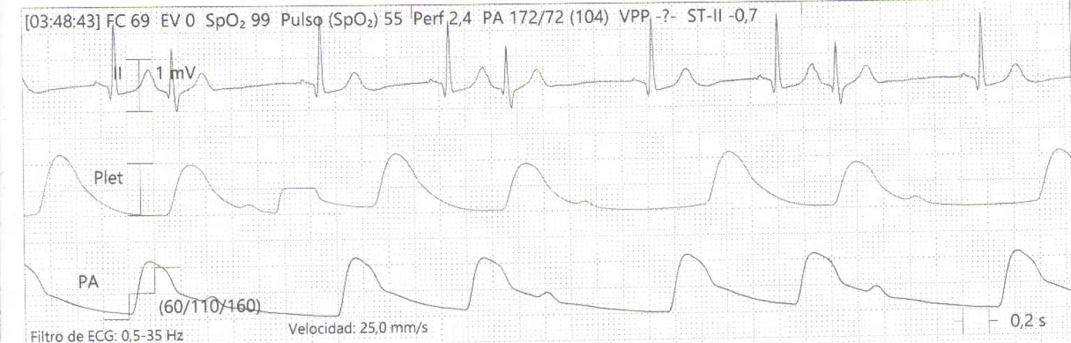 Imagen clínica de la pregunta de Cardiovascular y Respiratorio