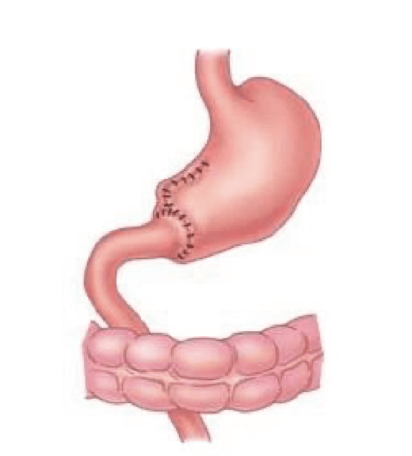 Imagen clínica de la pregunta de Bloque Quirúrgico y Perioperatorio