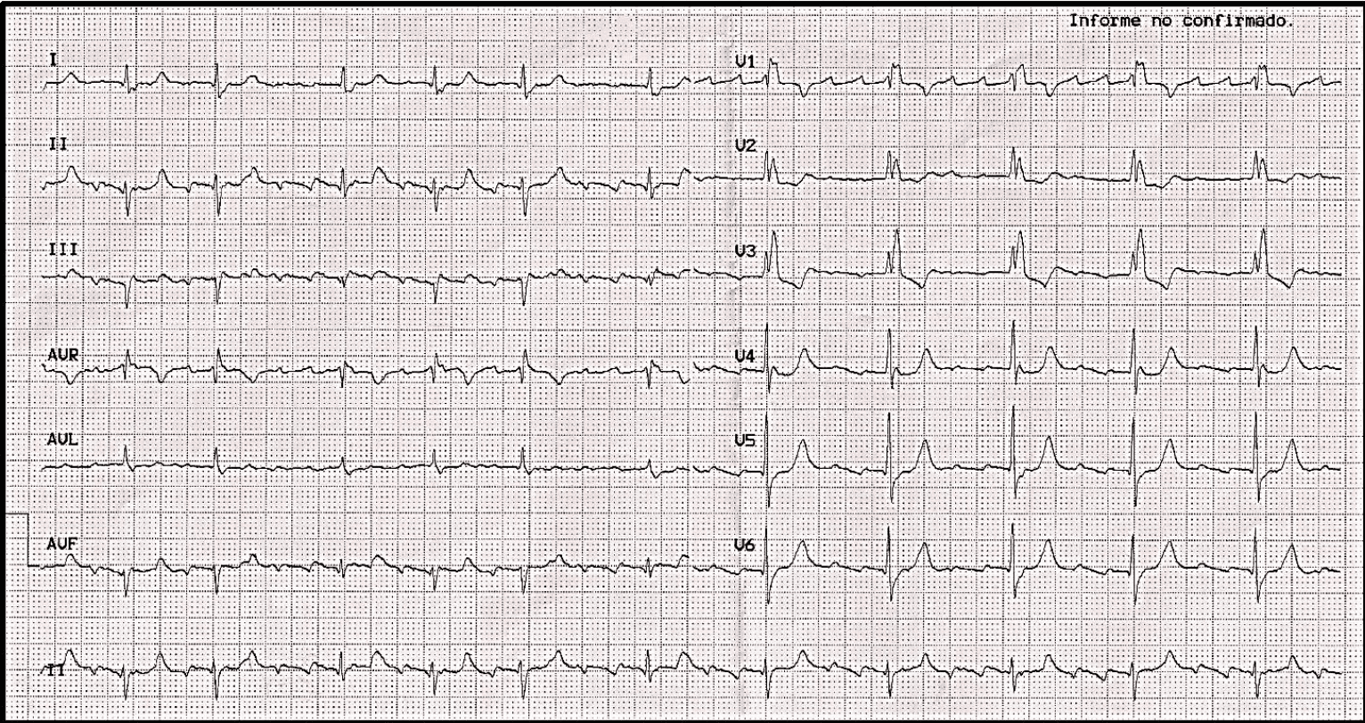 Imagen clínica de la pregunta de Cardiovascular y Respiratorio