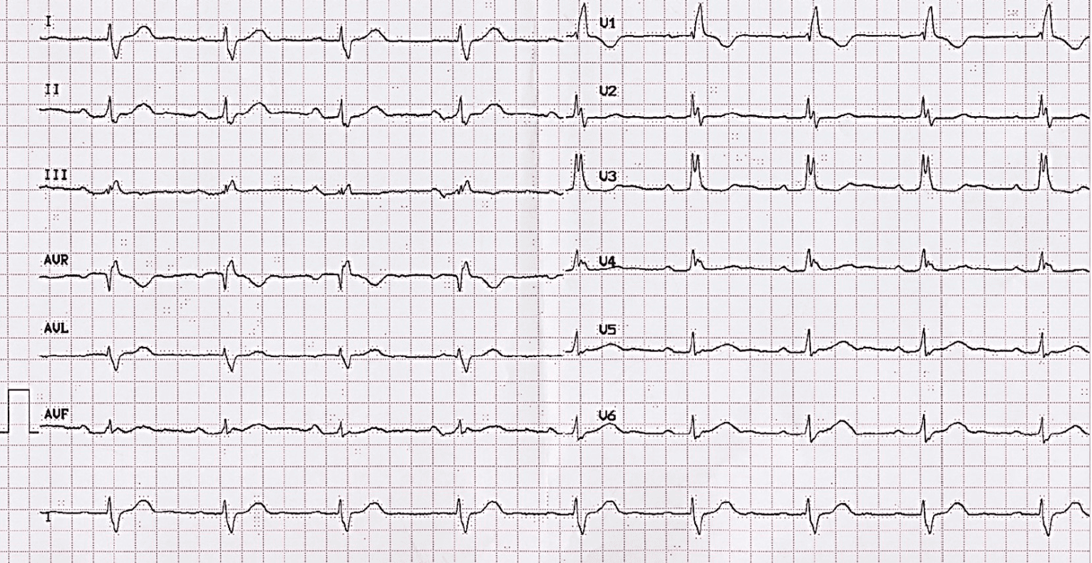 Imagen clínica de la pregunta de Cardiovascular y Respiratorio