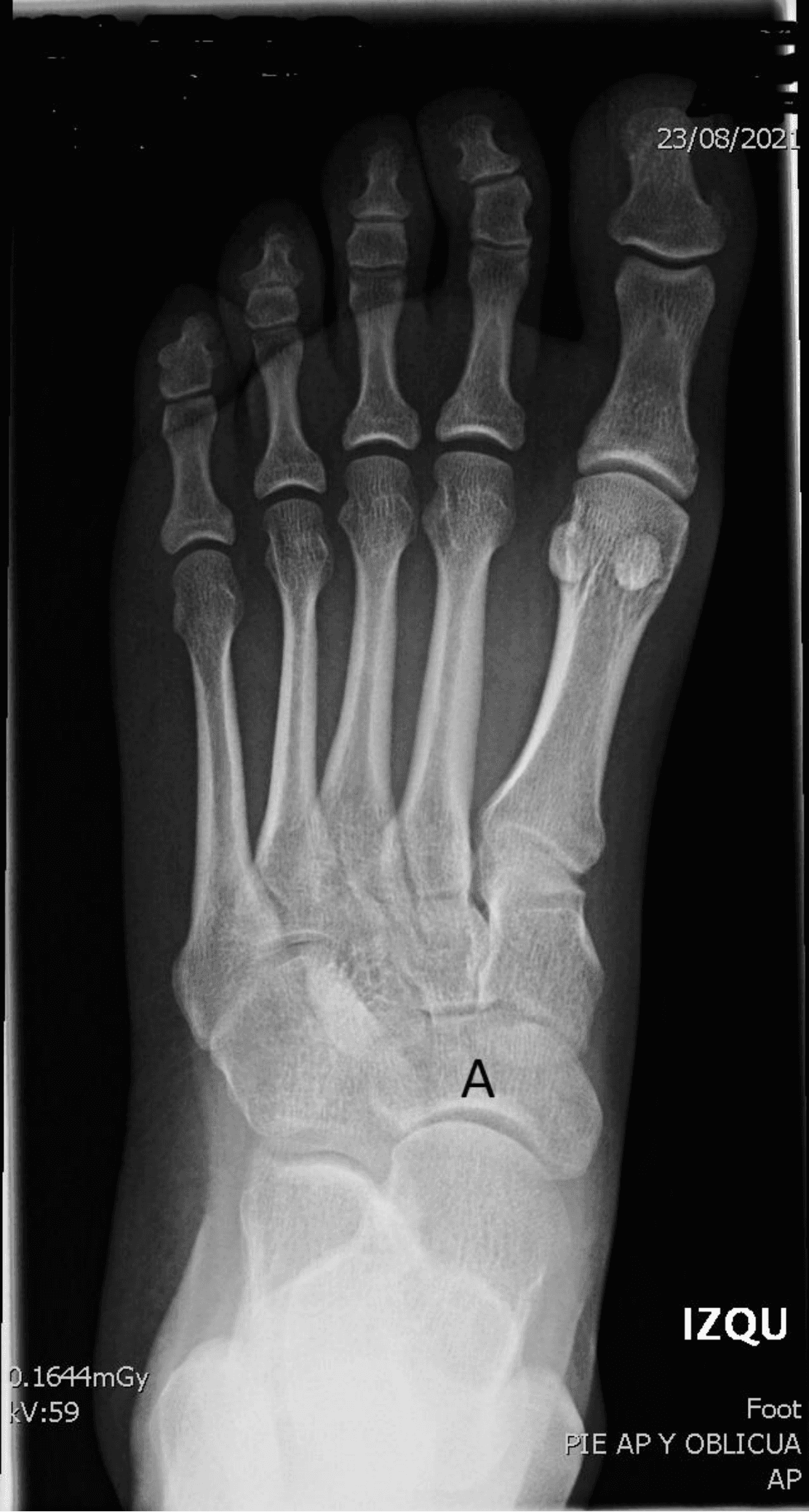 Imagen clínica de la pregunta de Traumatología y Cuidado de Heridas