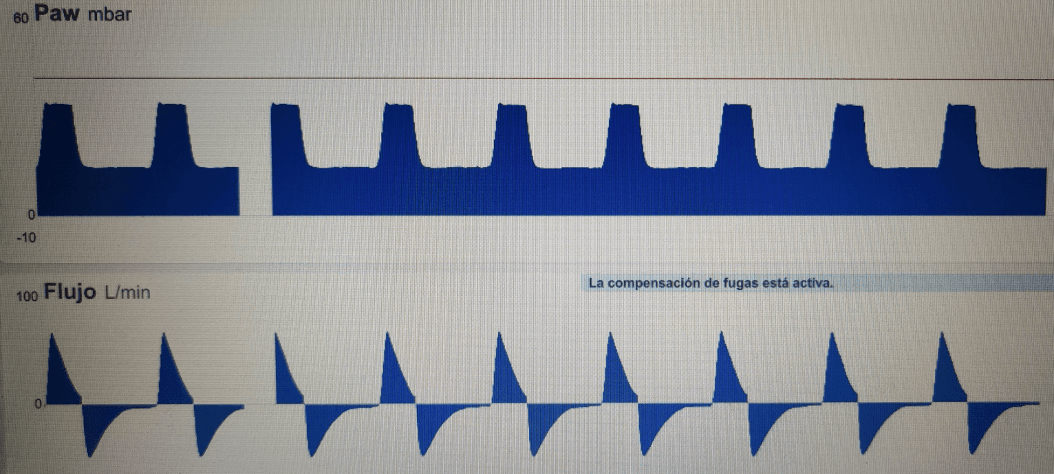 Imagen clínica de la pregunta de Paciente Crítico, Urgencias y Emergencias