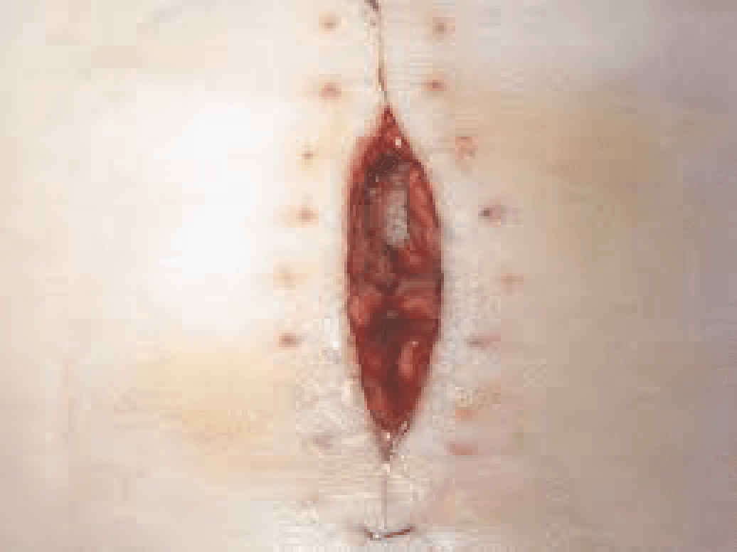 Imagen clínica de la pregunta de Traumatología y Cuidado de Heridas
