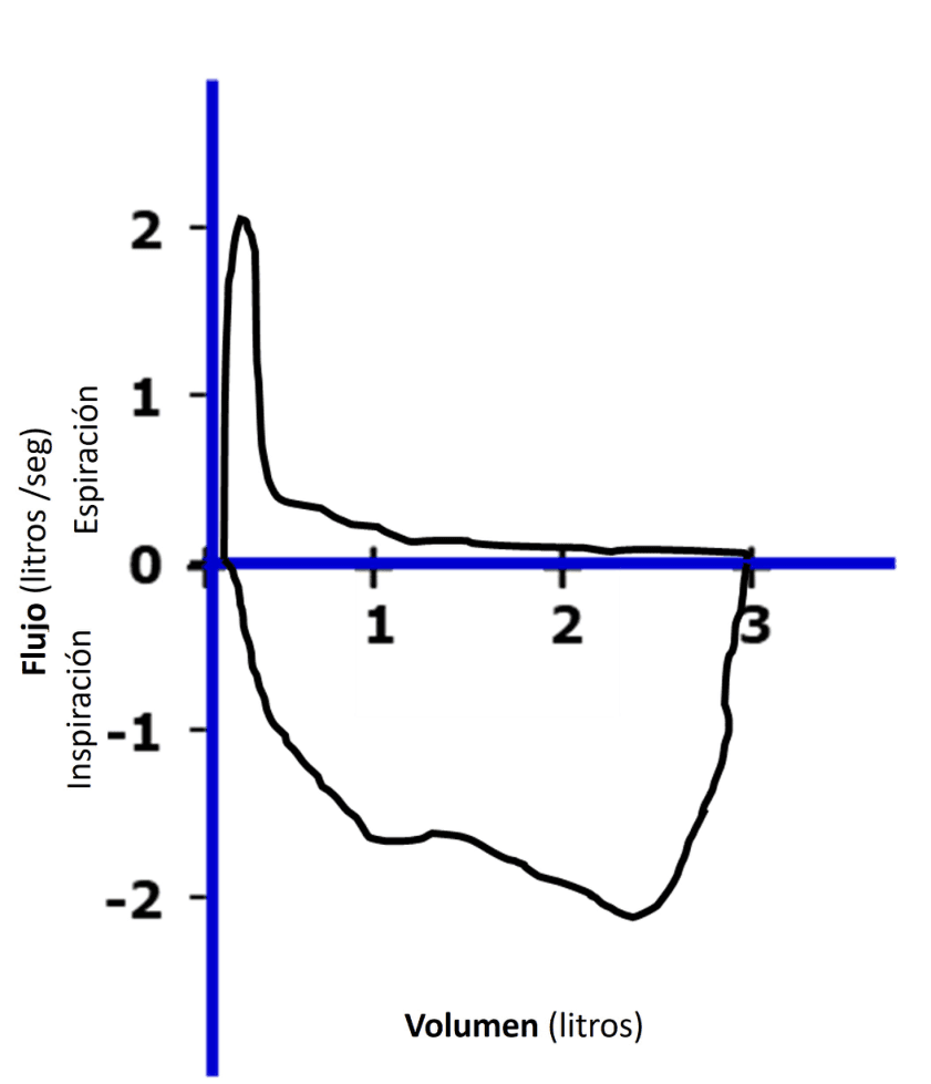 Imagen clínica de la pregunta de Cardiovascular y Respiratorio